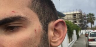 “Io aggredito perché omosessuale”: la denuncia del giovane barlettano Daniele