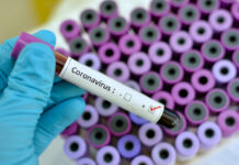 Coronavirus, 954 nuovi positivi in Puglia: + 40 nella Bat