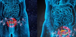 Congresso scientifico al “Dimiccoli” sul carcinoma prostatico: attualità e prospettive